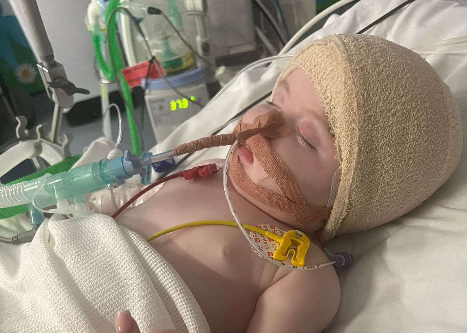 Baby diagnosed with brain tumour aged three months celebrates birthday at home